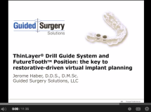 gss-drill-guide-and-implant-plannign-demo-215x160