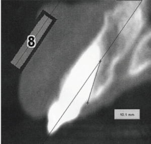 oblique-surface-1